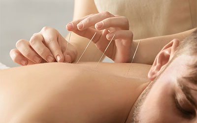Unlock the Healing Potential of Acupuncture Treatment at Shoppers World Physiotherapy