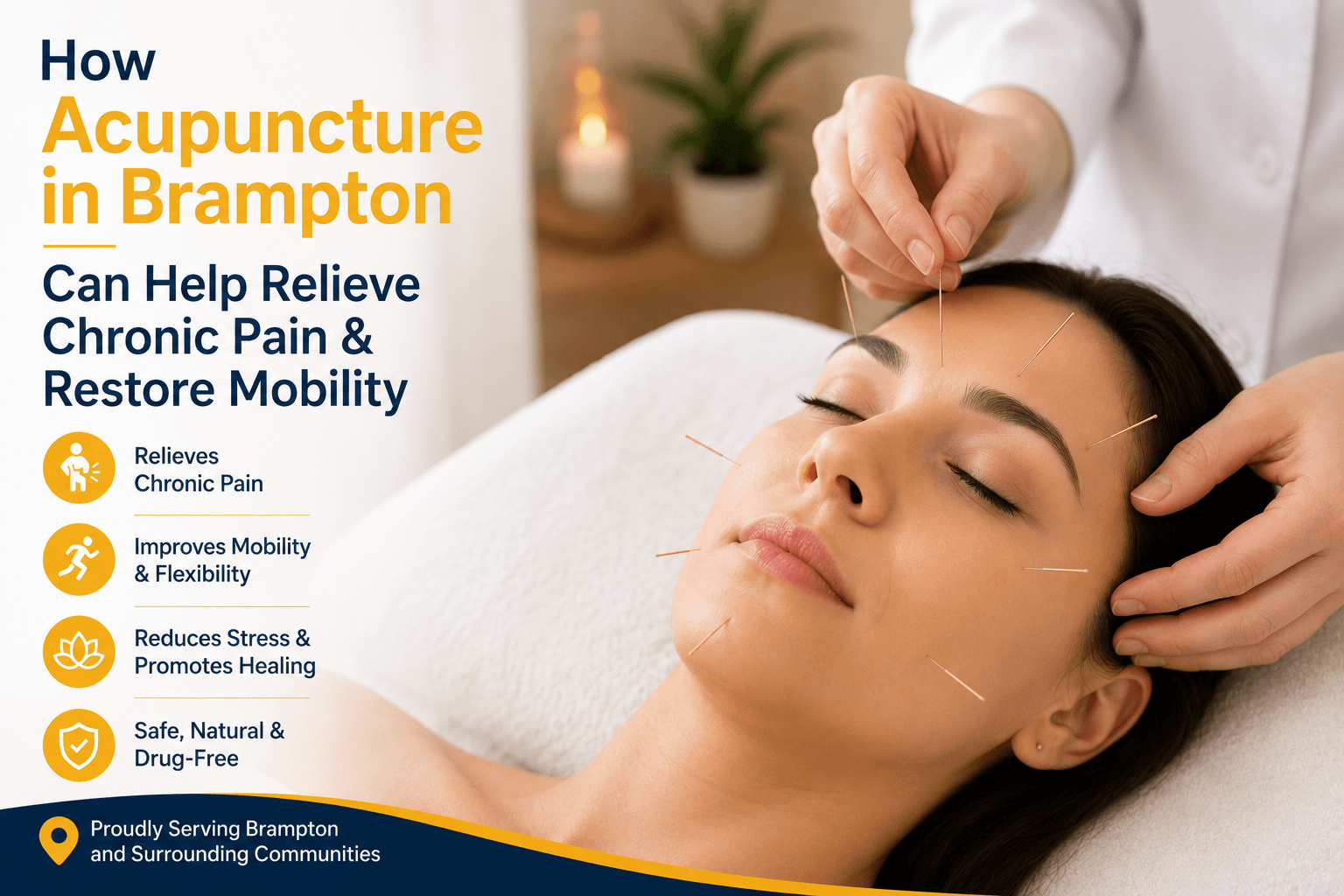 Acupuncture in Brampton Acupuncture in Brampton